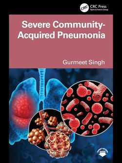 Severe Community Acquired Pneumonia Paperback – 2025