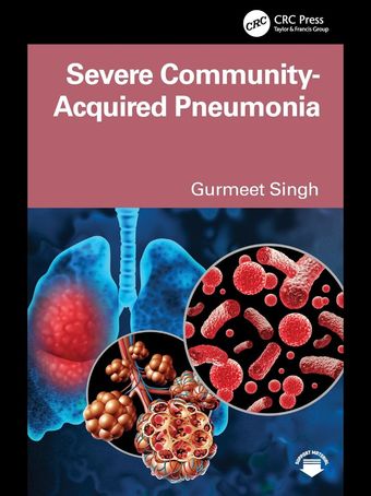 Severe Community Acquired Pneumonia  2025