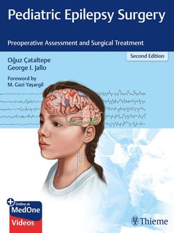 Pediatric Epilepsy Surgery: Preoperative Assessment and Surgical Treatment +Video 2020