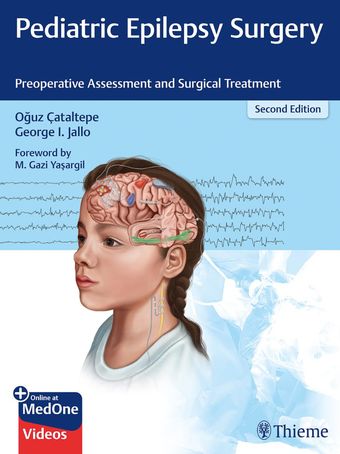 Pediatric Epilepsy Surgery: Preoperative Assessment and Surgical Treatment +Video 2020