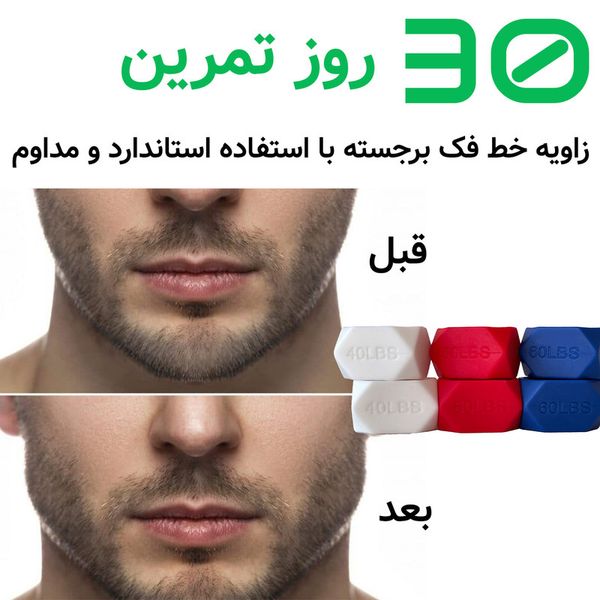 دستگاه تقویت فک