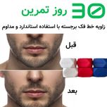 دستگاه تقویت فک
