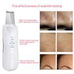 اتو صورت التراسونیک