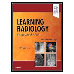 کتاب Learning Radiology: Recognizing the Basics اثر William Herring انتشارات مؤلفین طلایی