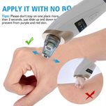 میکرودرم خانگی