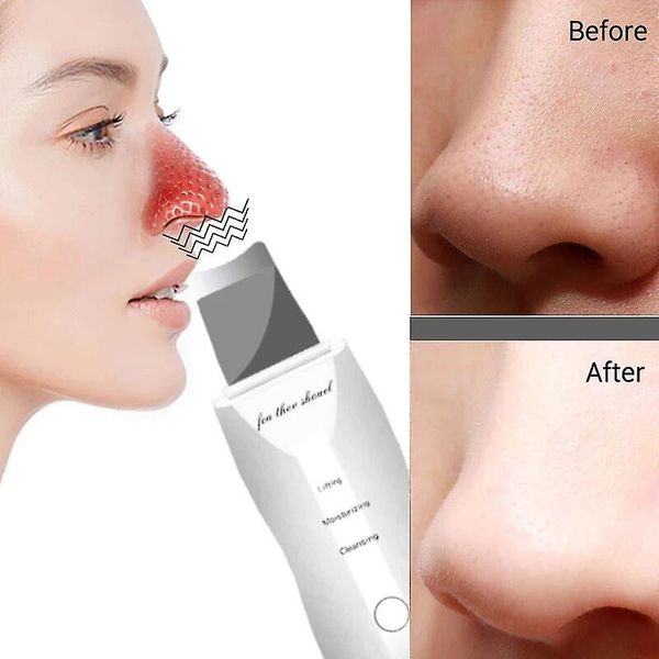 دستگاه پاکسازی صورت