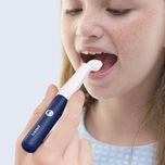 گوش پاک کن هوشمند شیائومی، بی‌برد مدل Bebird I35R