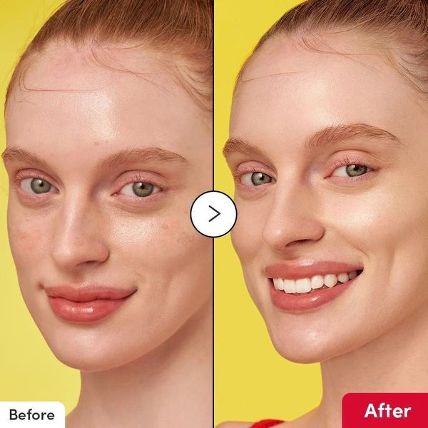 سرم روشن کننده و ضدلک ویتامین سی ایکوالبری Eqqual Berry VitaminC Dark Spot Serum