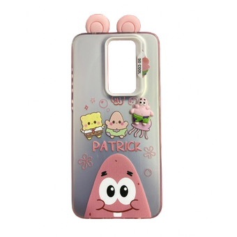 قاب PC SO COOL گوش دار XIAOMI Redmi note 8 Pro