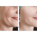 کرم لیفتینگ و ضدچروک دکتر التیا Rapid Firm Sculpting Cream