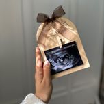 اکسسوری نوزاد قاب سونوگرافـی