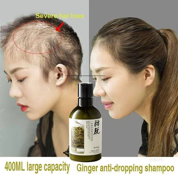 شامپو ضد ریزش مو رزماری