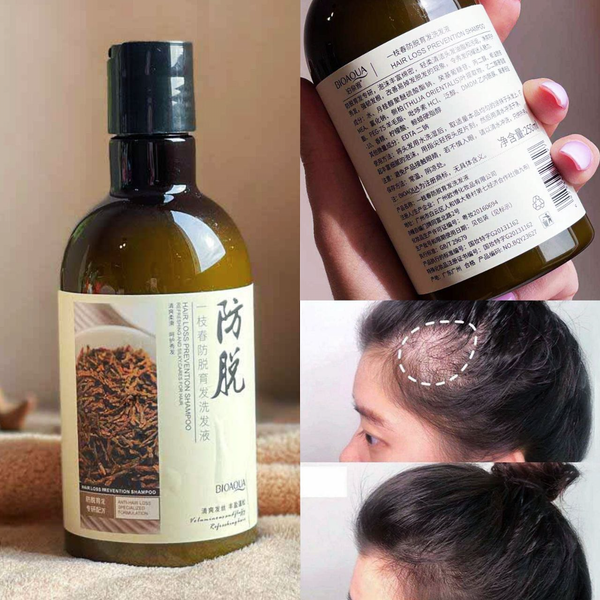 شامپو ضد ریزش مو رزماری