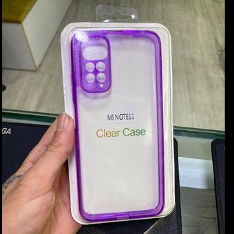 قاب شیائومی نوت 11