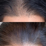 قرص مکمل تقویت کننده مو و ناخن فیتو فانر 4 مویز  Phyto Phytophanere Food Supplement For Hair And Nails