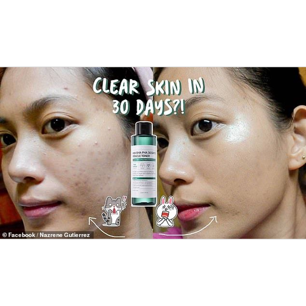 تونر ضد جوش و آبرسان 30 روزه میراکل سام بای می Some By Mi AHA BHA PHA 30 Days Miracle Toner