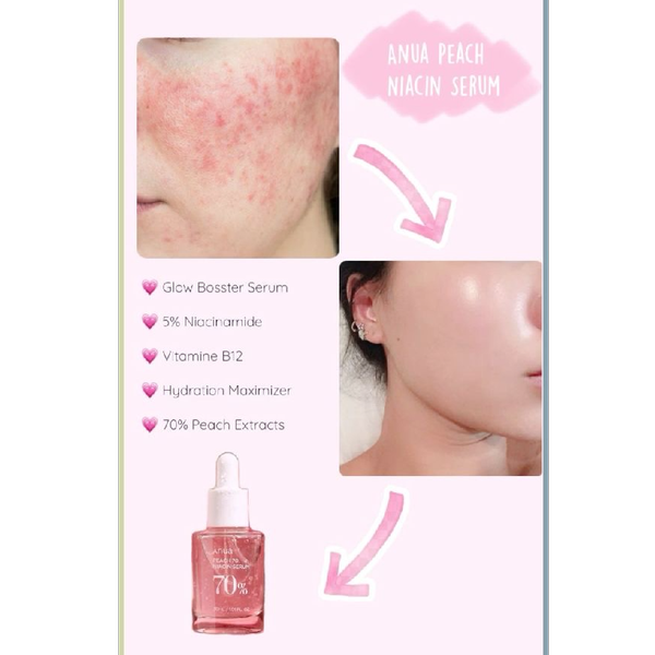 سرم روشن کننده نیاسینامید آنوا حاوی عصاره هلو Anua Peach 70% Niacin Serum