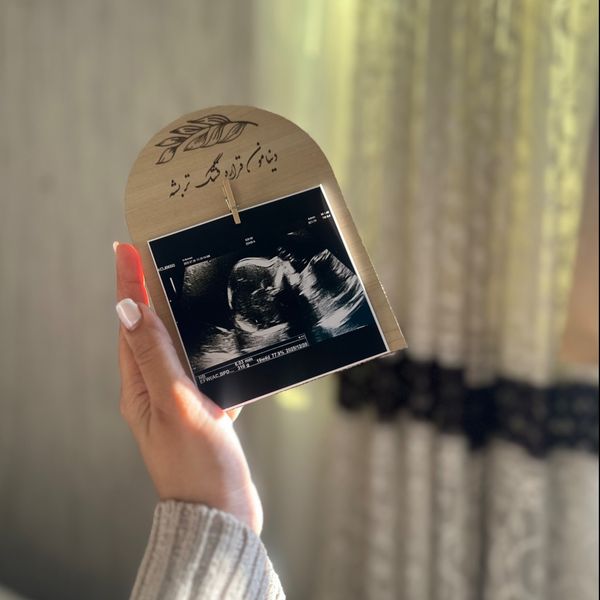 قاب سونوگرافی نوزاد