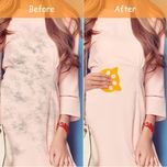 پرزگیر لباس