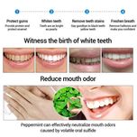 محلول سفید کننده دندان لنبنا مدل اسنس حجم 10 میلی لیتر