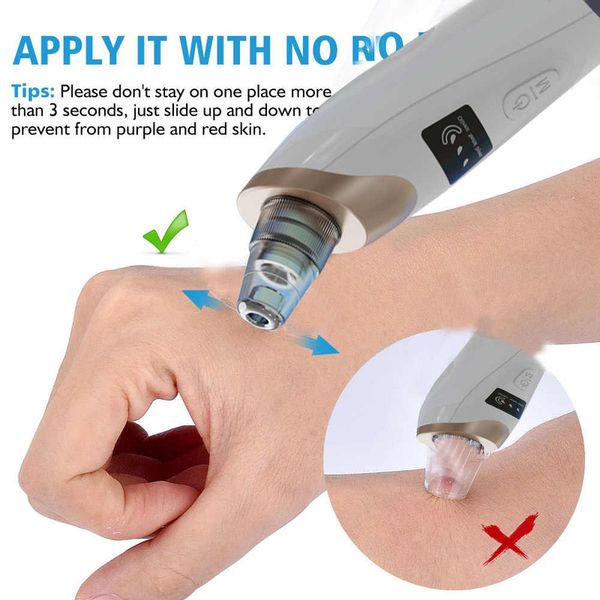 میکرودرم خانگی