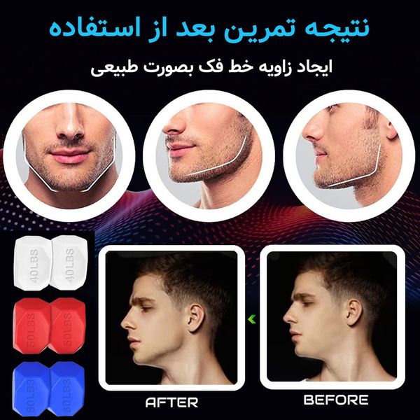 دستگاه تقویت فک