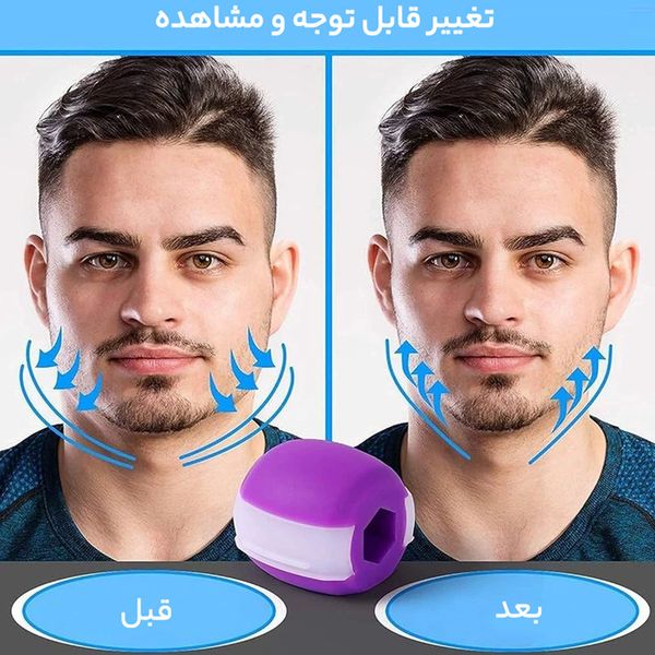 دستگاه زاویه ساز و تقویت فک