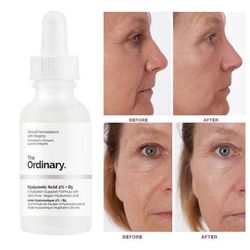 سرم دی اوردینری مدل Hyaluronic Acid حجم ۳۰ میلی لیتر
