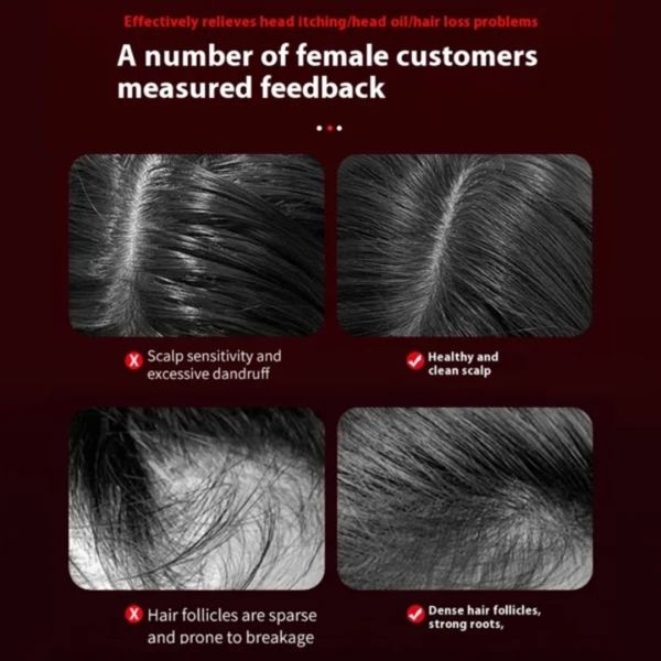 کیت آسایش تابستان سانوایبز