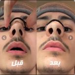 : 😴 نوار مغناطیسی ضد خروپف