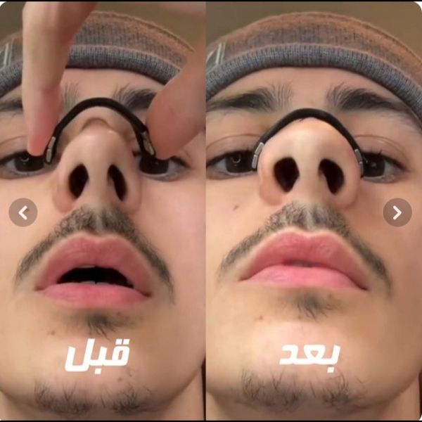 : 😴 نوار مغناطیسی ضد خروپف