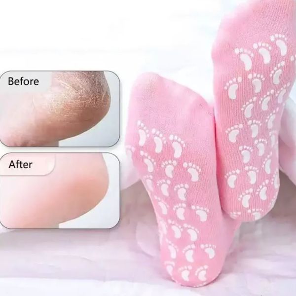 جوراب سیلیکونی رفع ترک پا