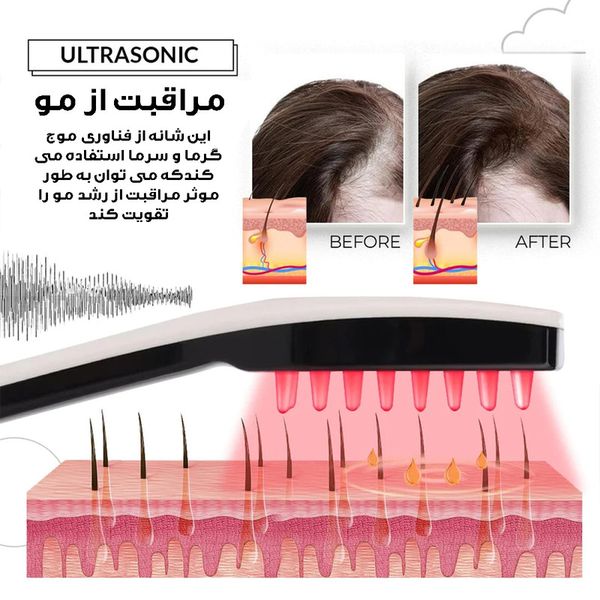 ماساژور سر برقی