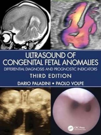 Ultrasound of Congenital Fetal Anomalies: Differential Diagnosis and Prognostic Indicators 3rd Edition 2024