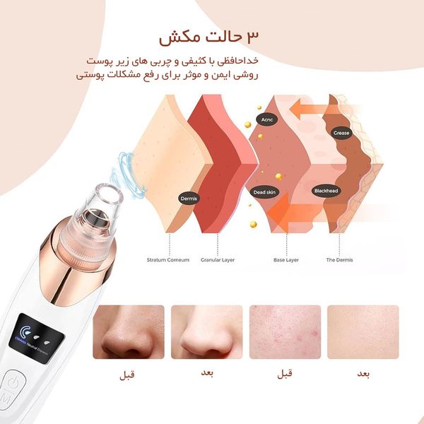 میکرودرم