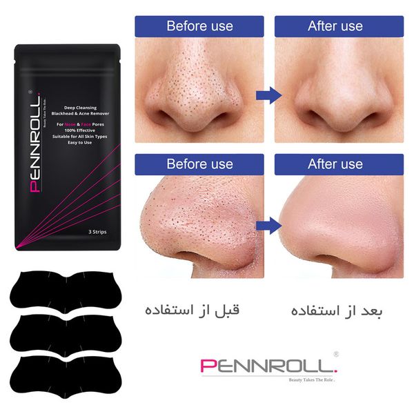 چسب‌ پاک کننده بینی پنرول مدل PRD - Deep Blackhead Acne Cleanser  عددی 1