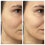 تونر سنتلا مدل HYALU-CICA Brightening حجم 210 میلی لیتر