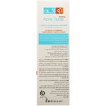 اسپری ضد جوش بدن نو آکنه 150 میلی‌لیتر (No Acne Body Anti-Blemish Spray)