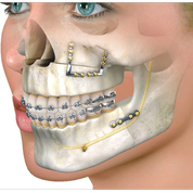 دندان پزشکی  (Dentistry)