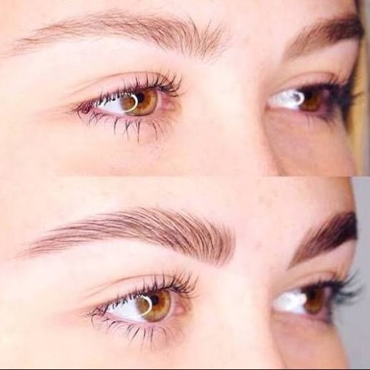 ژل لیفت ابرو گابرینی