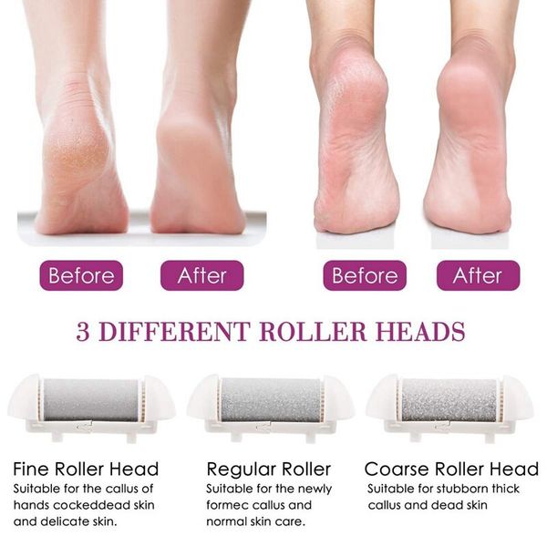 سنگ پا برقی