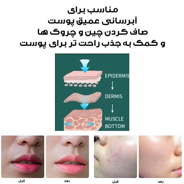 دستگاه ابرسان پوست