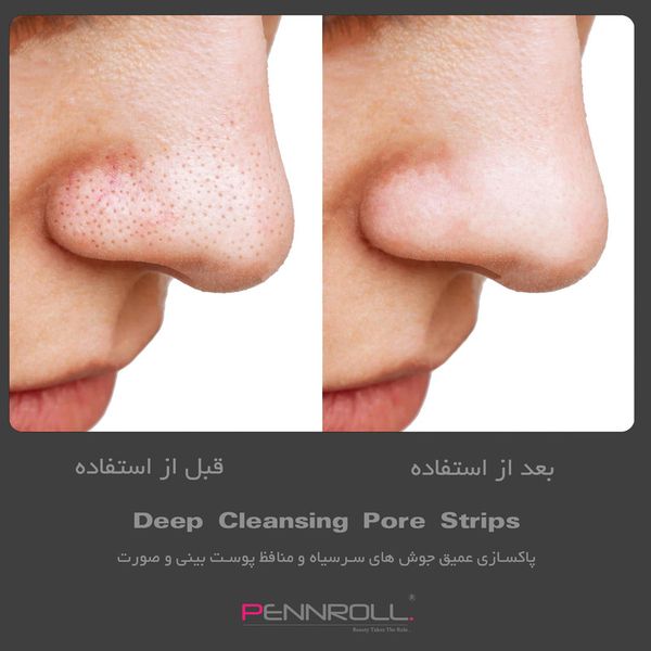 چسب‌ پاک کننده بینی پنرول مدل PRD - Deep Blackhead Acne Cleanser  عددی 1