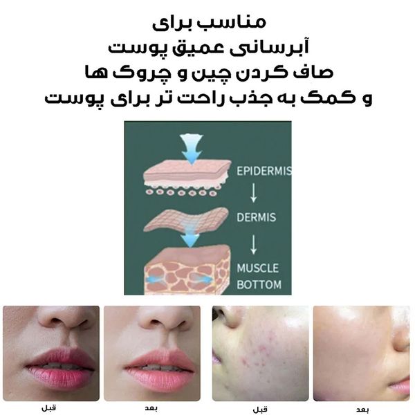 دستگاه آبرسان پوست