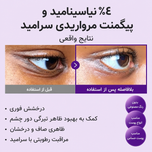 کرم دور چشم نامبوزین شماره 9