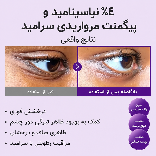 کرم دور چشم نامبوزین شماره 9