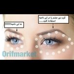 کرم دور چشم برنج بیواکوا