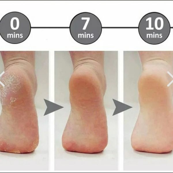 سنگ پای برقی