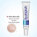 کرم ضد جوش بایو آکوا مدل REMOVAL حجم 20 میلی لیتر