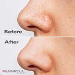 چسب‌ پاک کننده بینی پنرول مدل PRD - Deep Blackhead Acne Cleanser  عددی 1